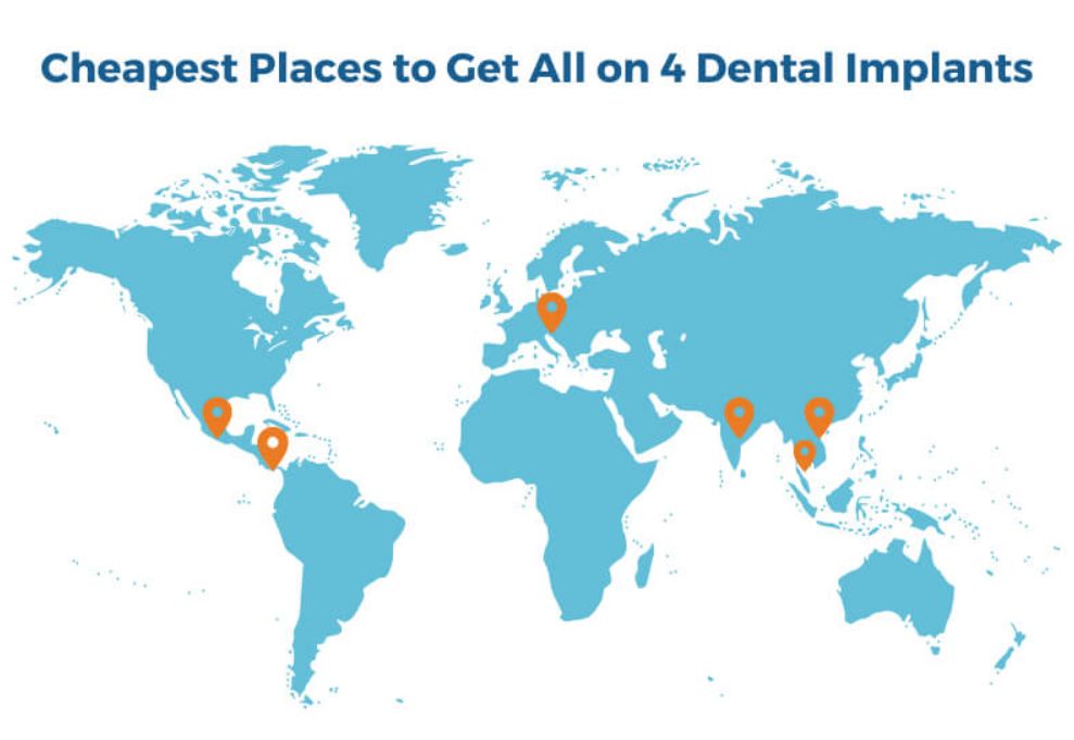 Dental Tourism Explained: Why More Americans Are Choosing Treatment Abroad