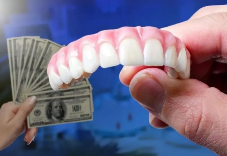 Dental implants abroad - your finance guide in the USA