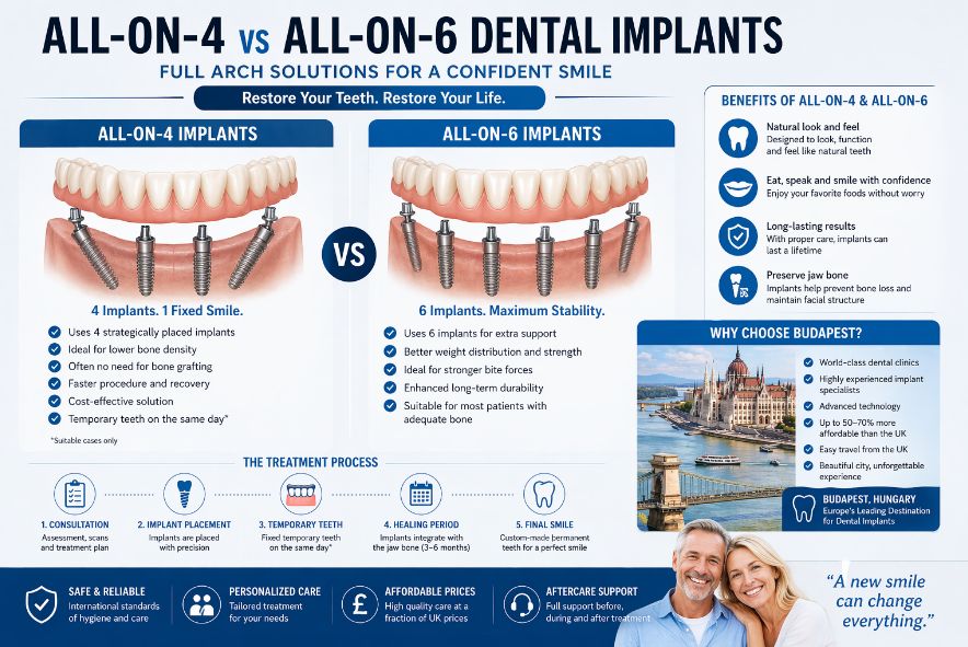 All on 4 vs All on 6 dental implants infographic comparing full arch implant solutions and benefits for UK patients considering treatment in Budapest